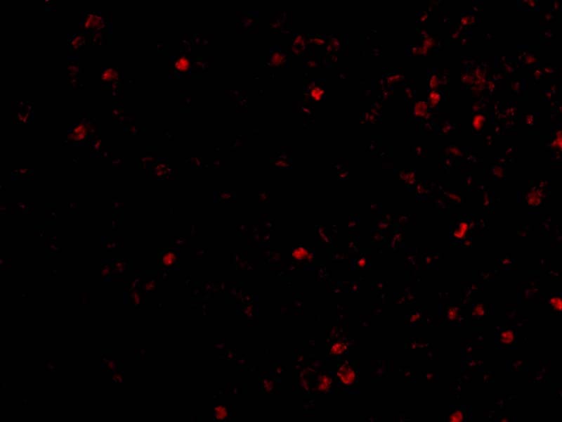 IKBKAP Antibody - BSA Free