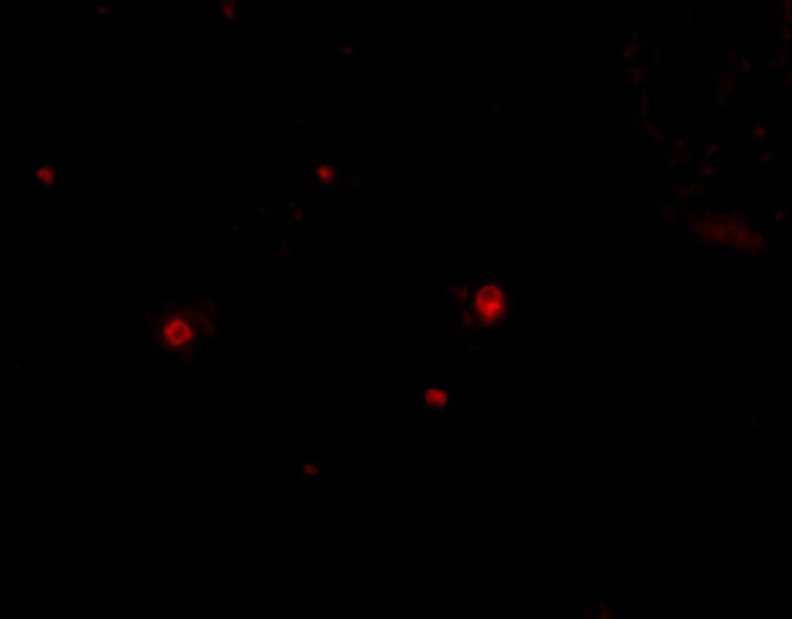 STIM2 Antibody - BSA Free