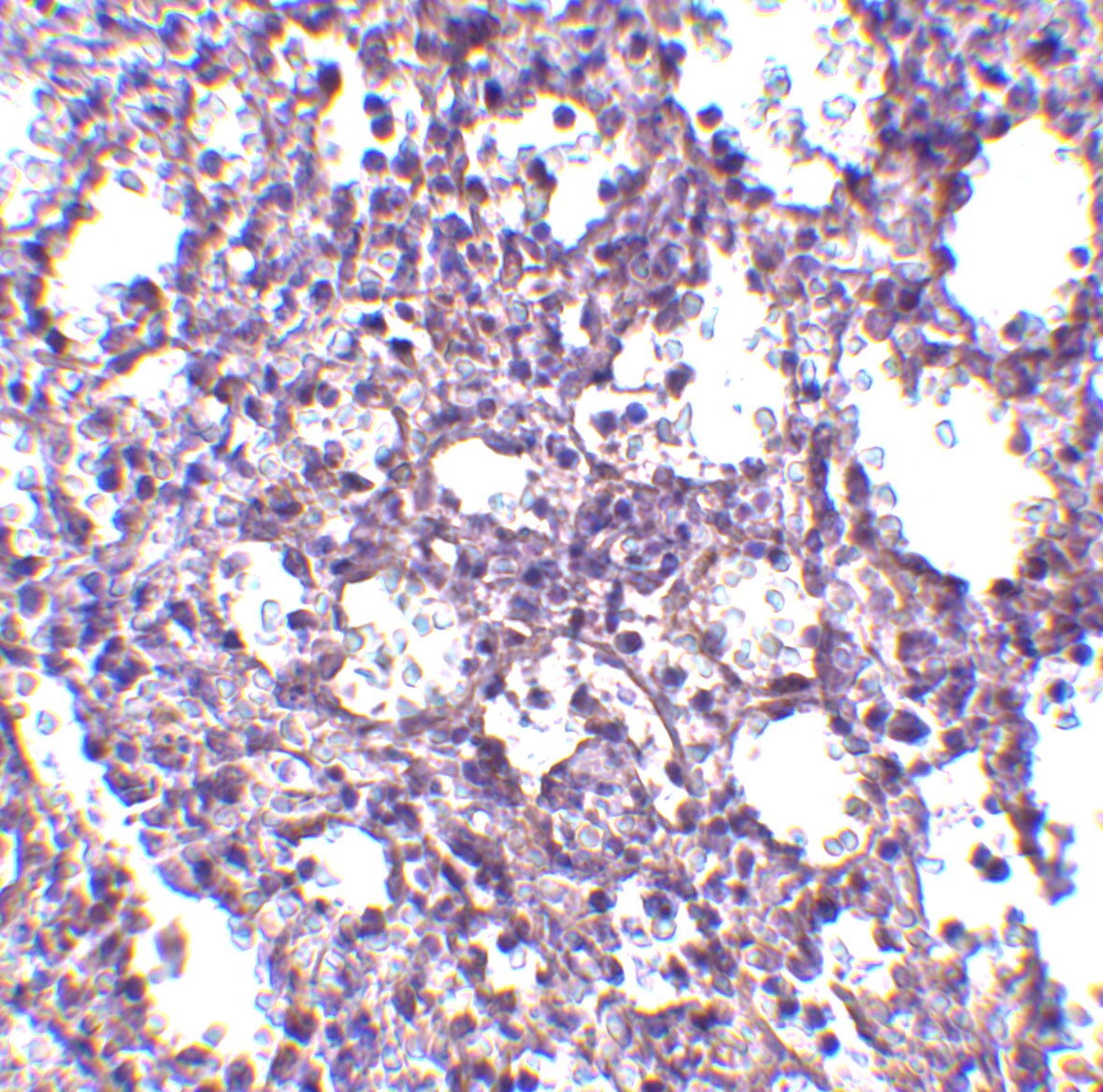 STIM2 Antibody - BSA Free