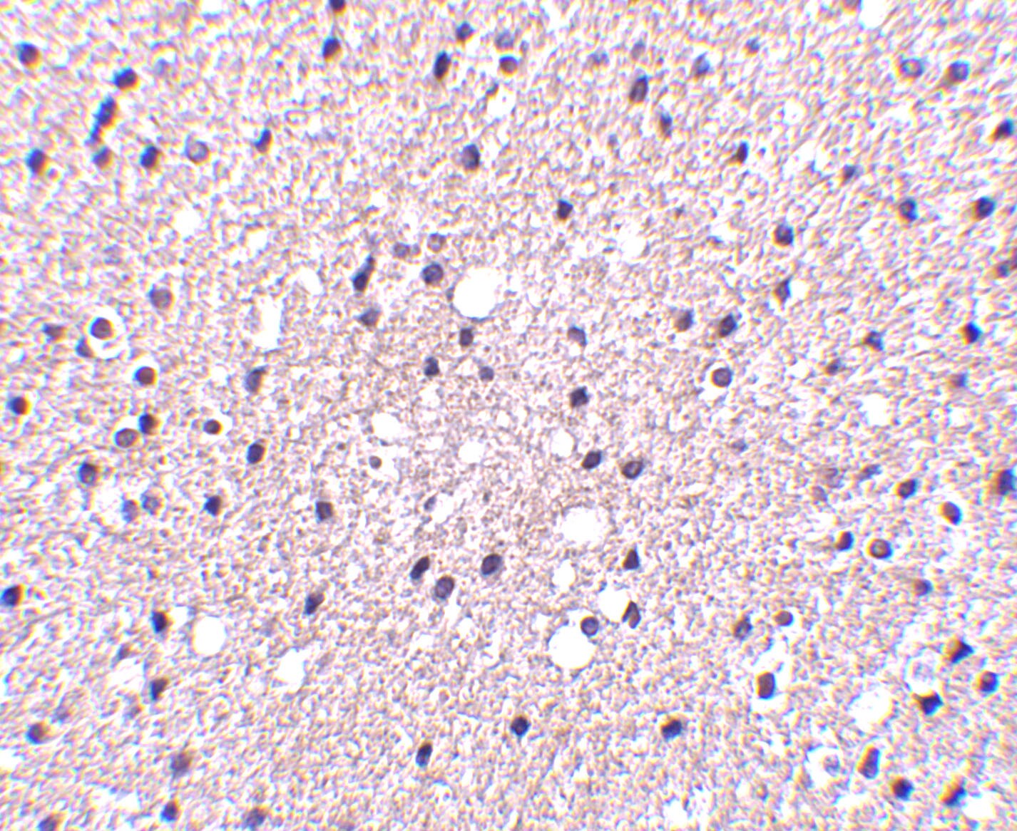 Presenilin-1 Antibody - BSA Free