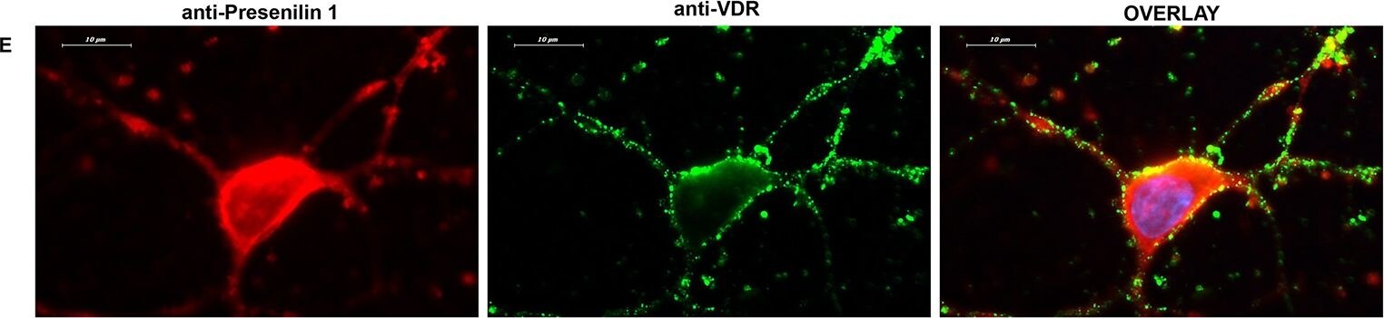 Presenilin-1 Antibody - BSA Free