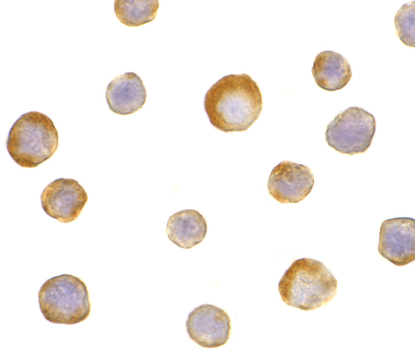IKK gamma Antibody - BSA Free