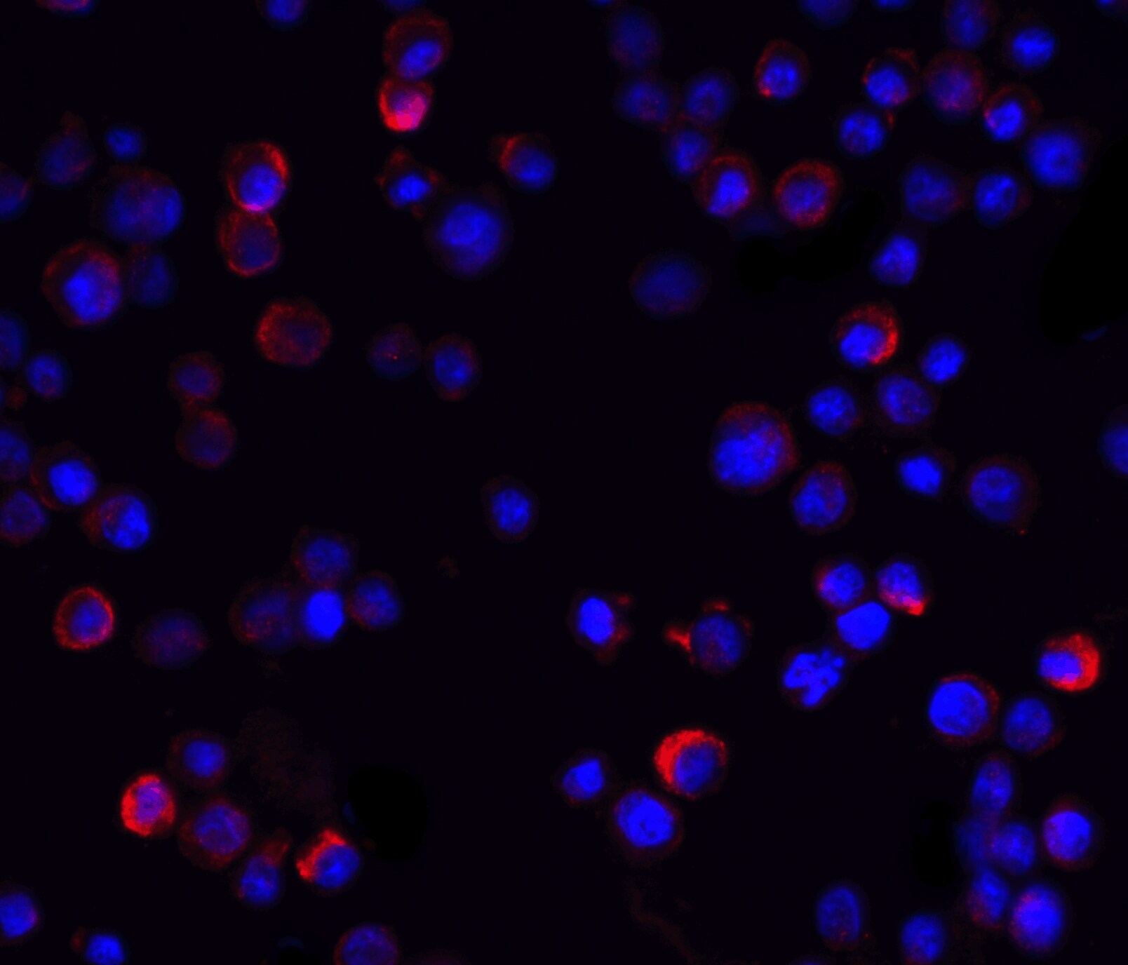 IKK gamma Antibody - BSA Free