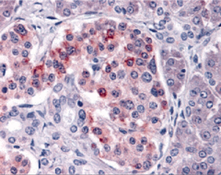 IKK epsilon/IKBKE Antibody - BSA Free