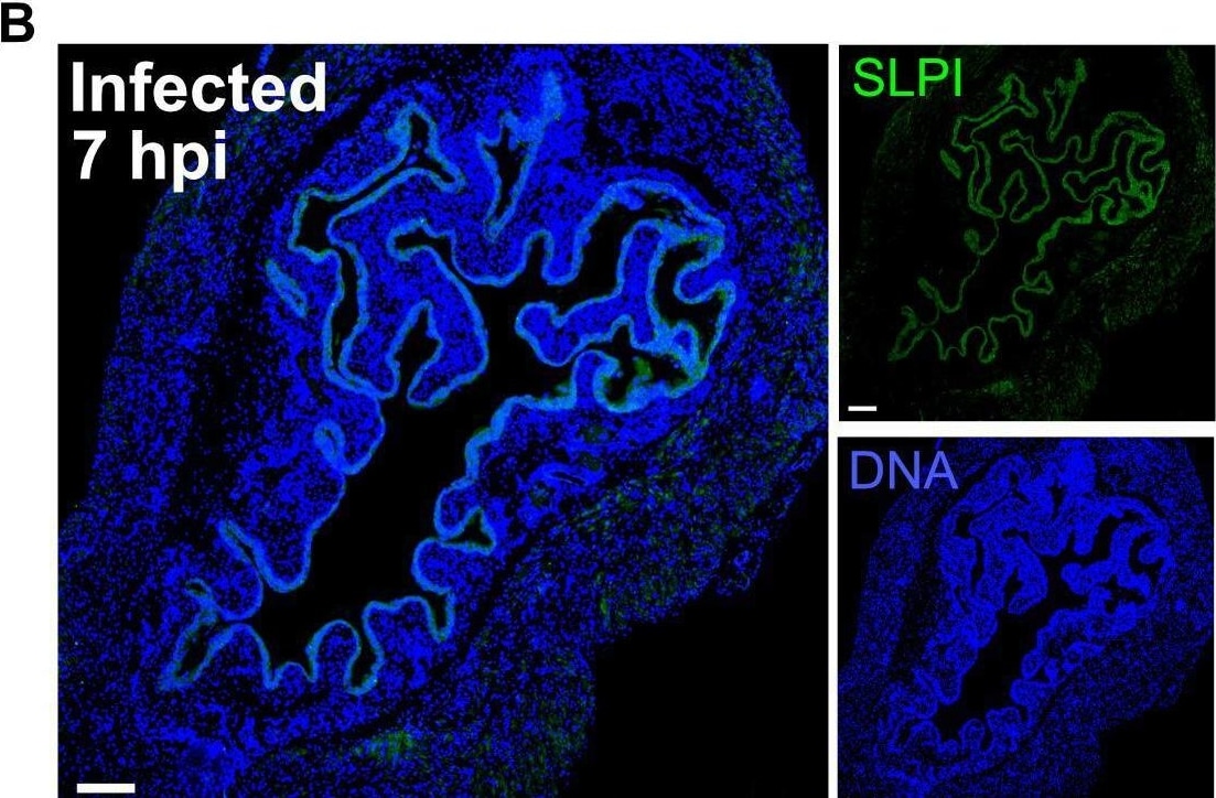 SLPI Antibody - BSA Free