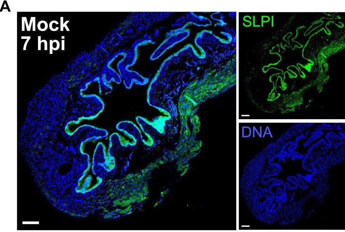 SLPI Antibody - BSA Free