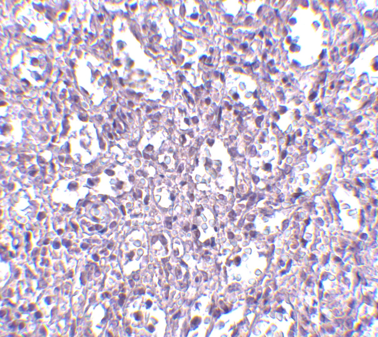 carabin Antibody - BSA Free