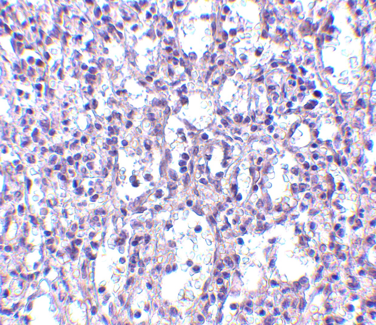 carabin Antibody - BSA Free
