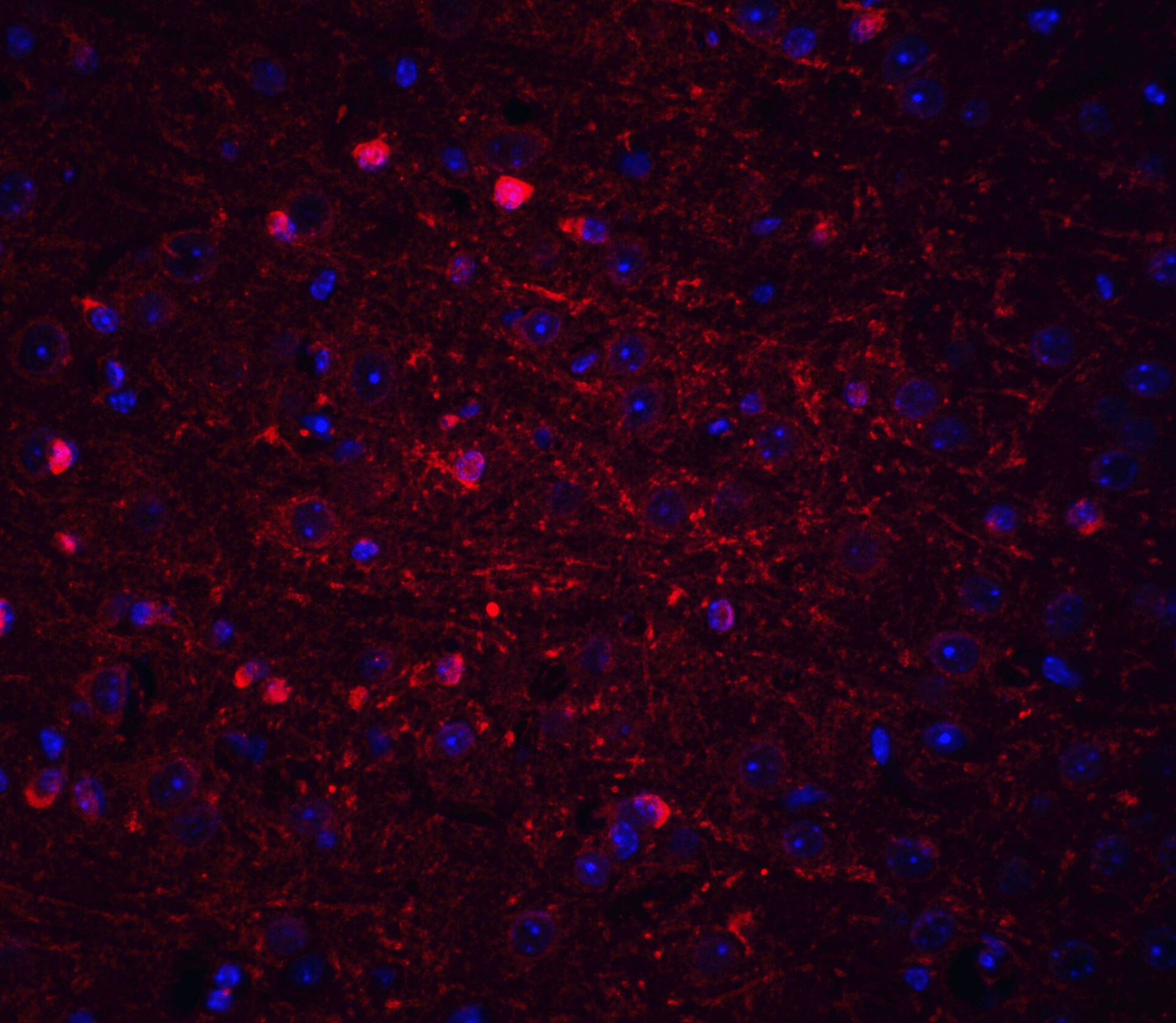 Kinesin 5A Antibody - BSA Free