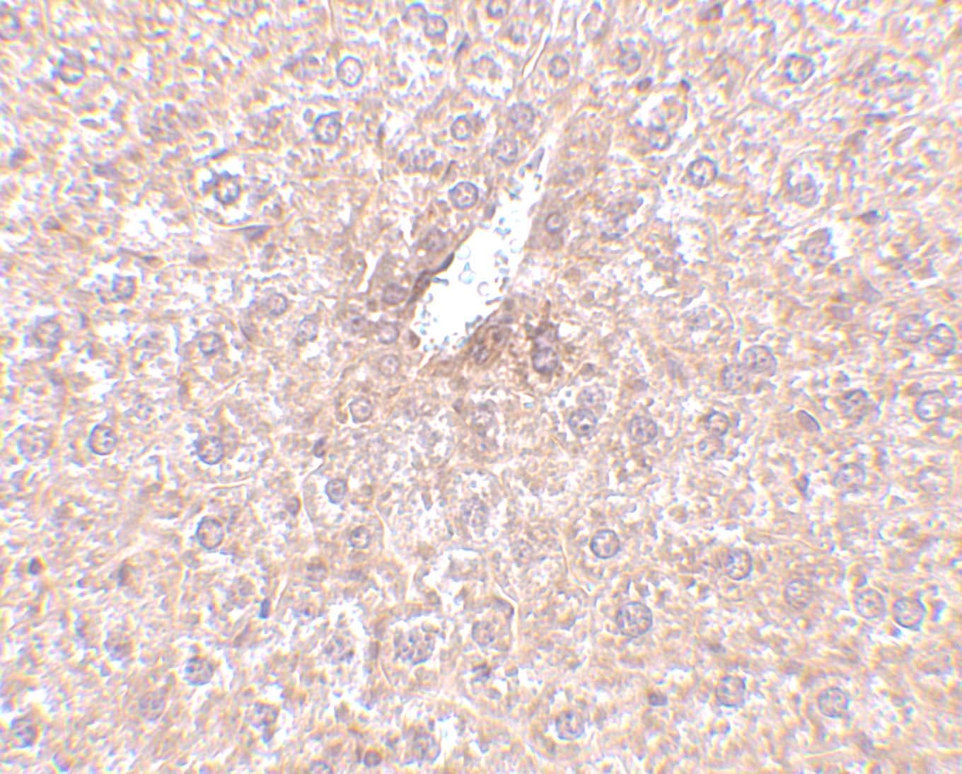 STEAP3/TSAP6 Antibody - BSA Free