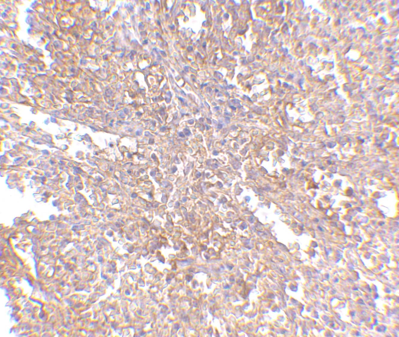 RAP80 Antibody - BSA Free