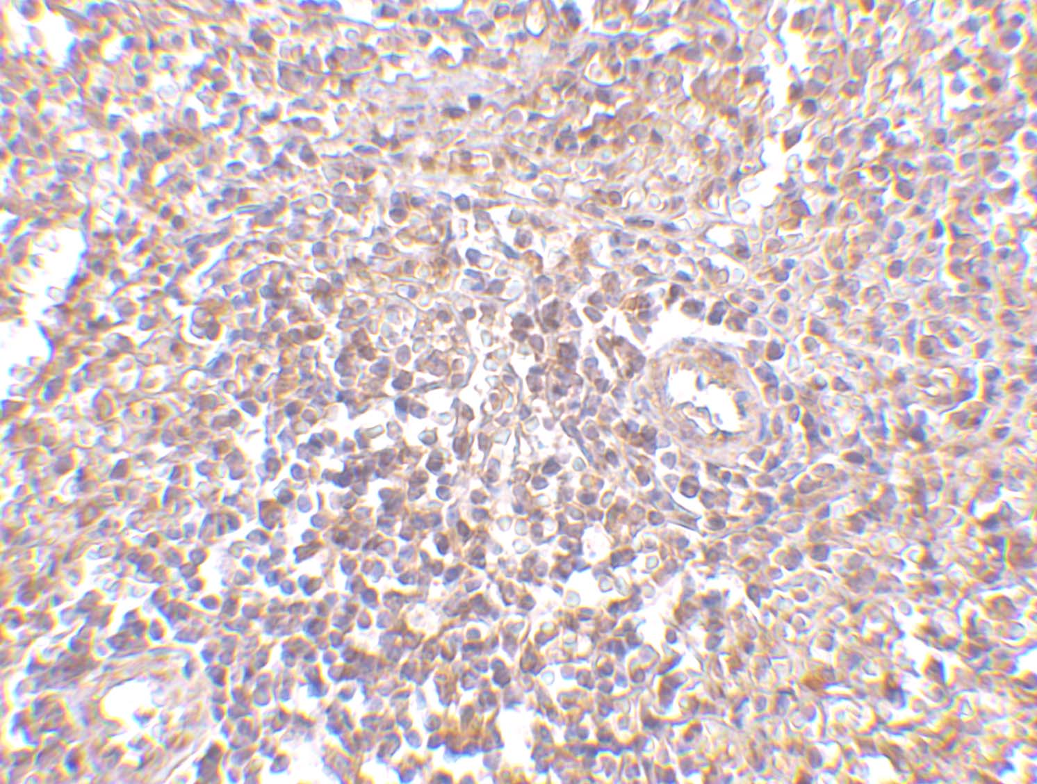 RAP80 Antibody - BSA Free