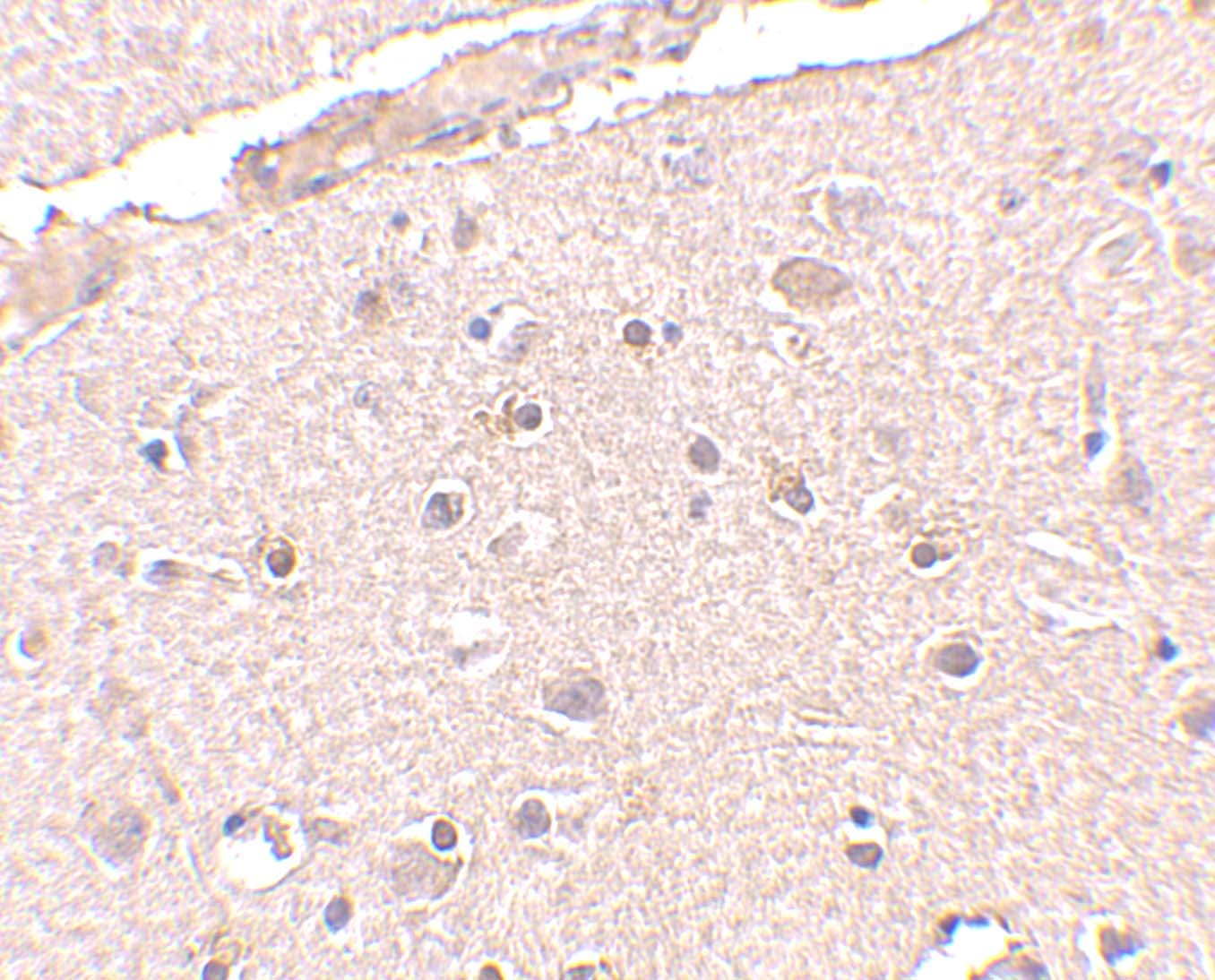 BRCC3 Antibody - BSA Free