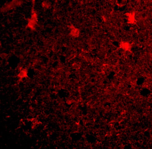 BRCC3 Antibody - BSA Free