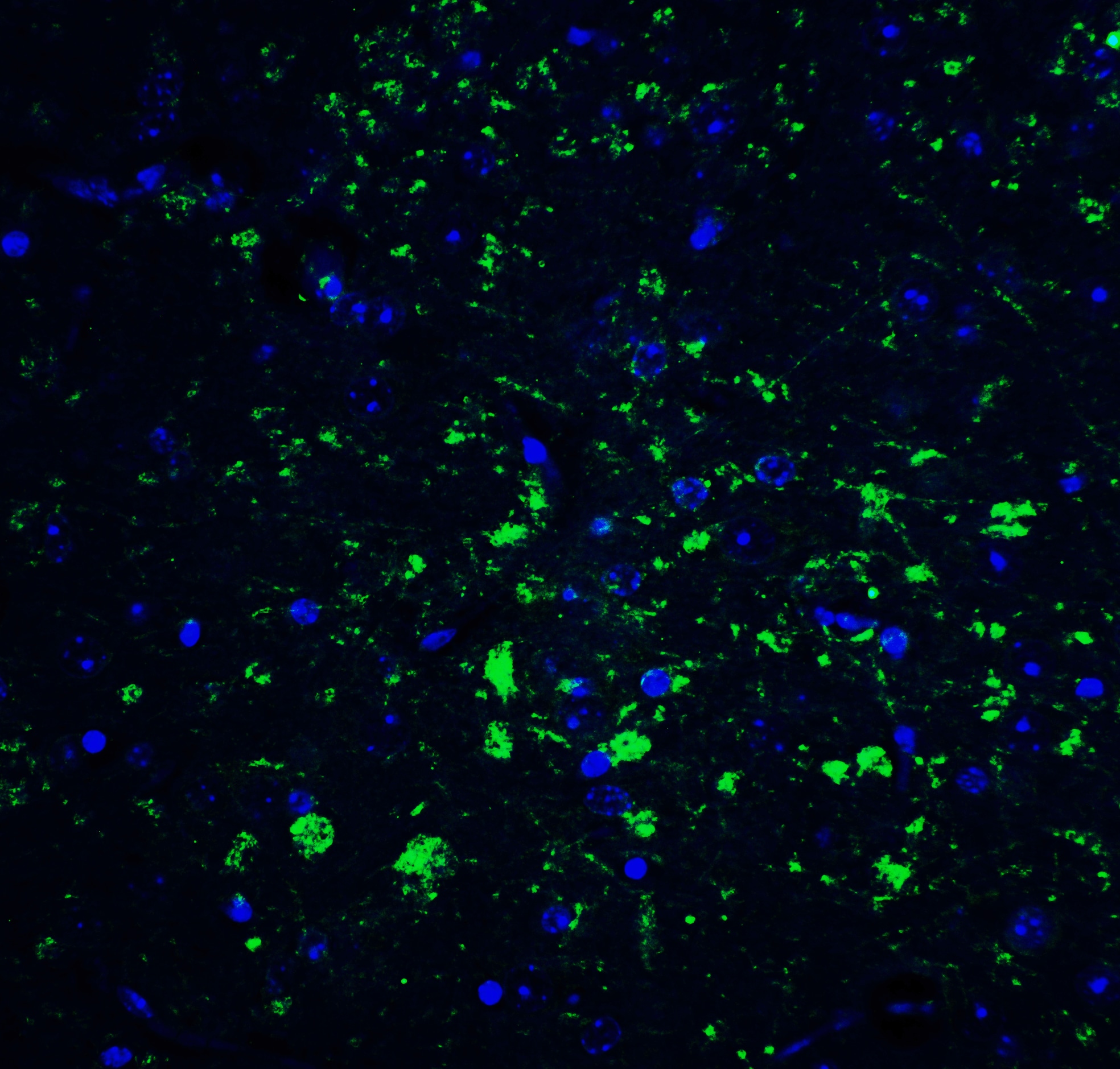 CDNF Antibody - BSA Free