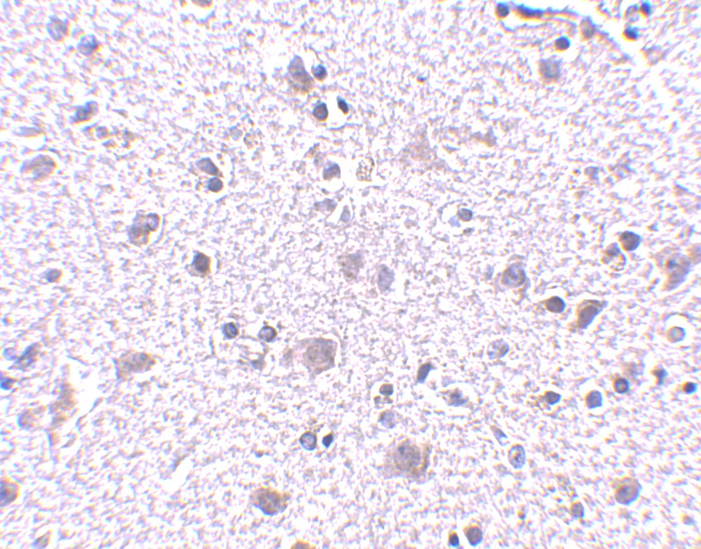 CDNF Antibody - BSA Free