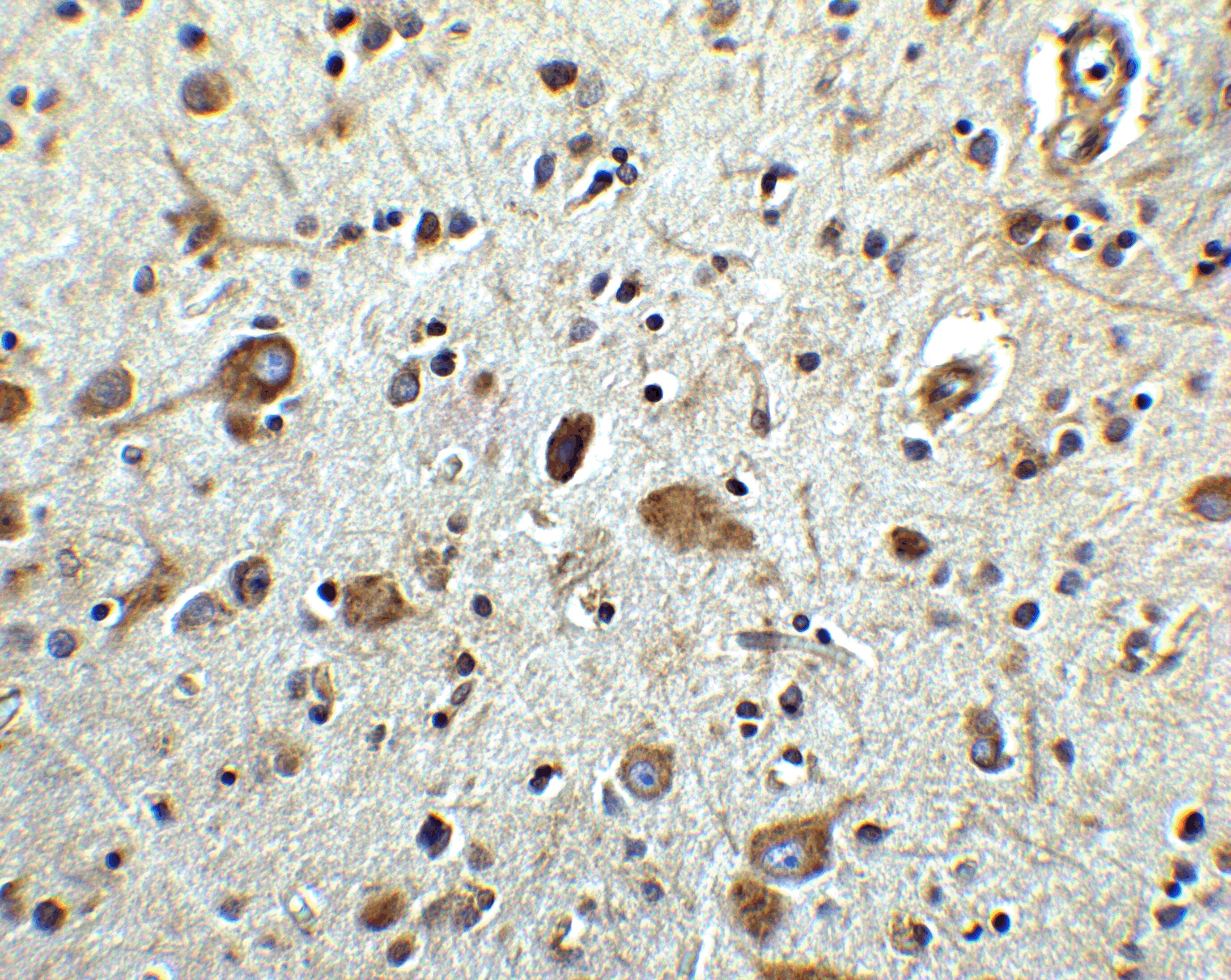 MANF Antibody - BSA Free