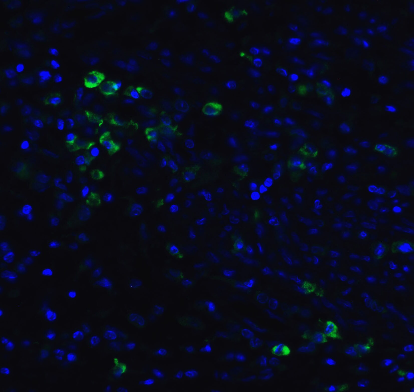 MANF Antibody - BSA Free