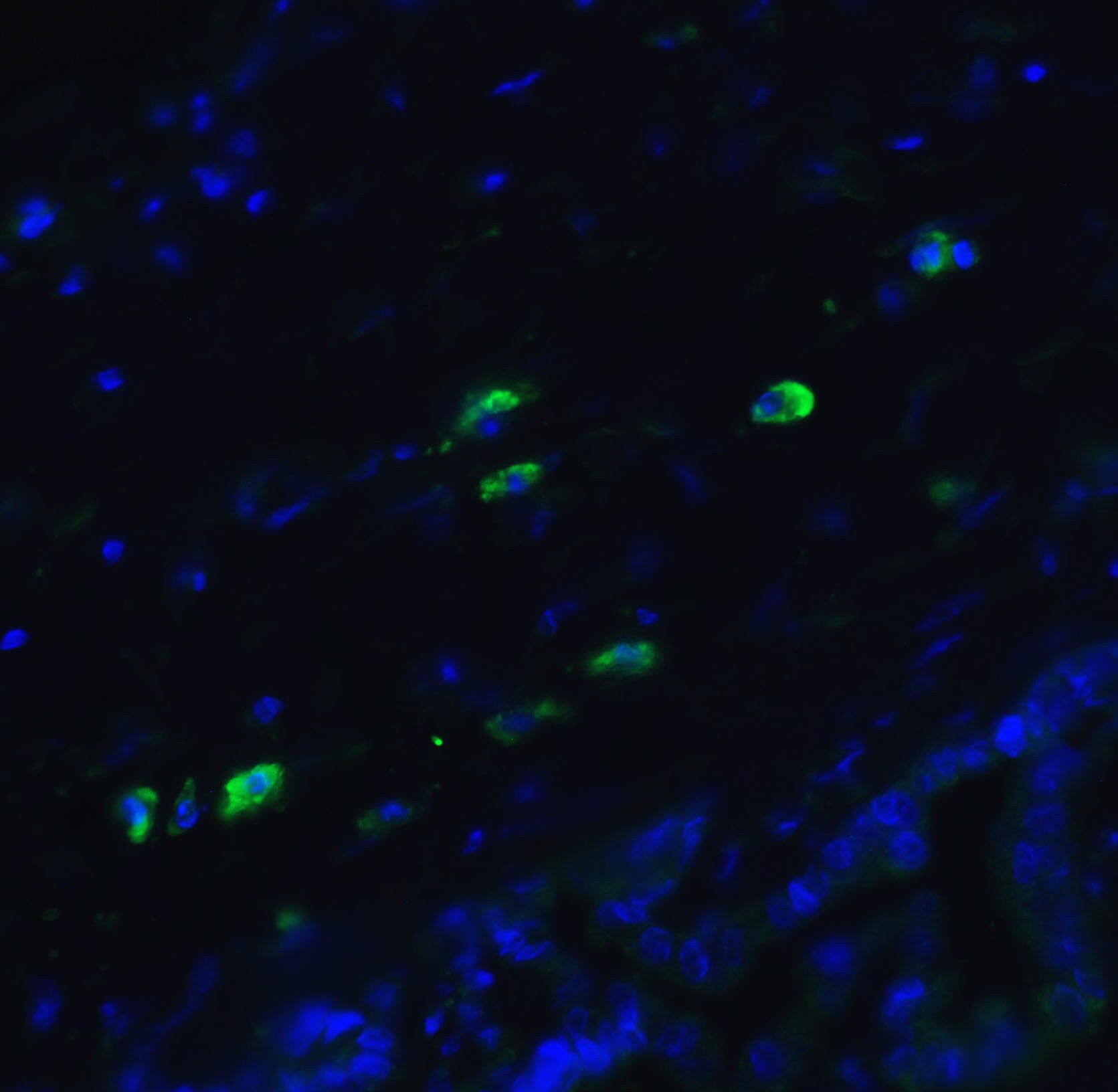 MANF Antibody - BSA Free