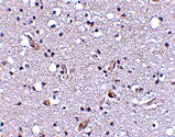 NHE1/SLC9A1 Antibody - BSA Free