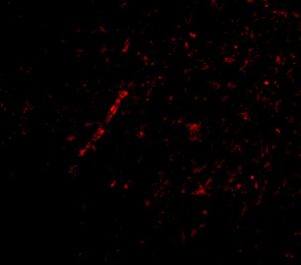 NHE1/SLC9A1 Antibody - BSA Free