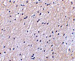 NHE1/SLC9A1 Antibody - BSA Free