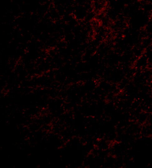 NHE1/SLC9A1 Antibody - BSA Free