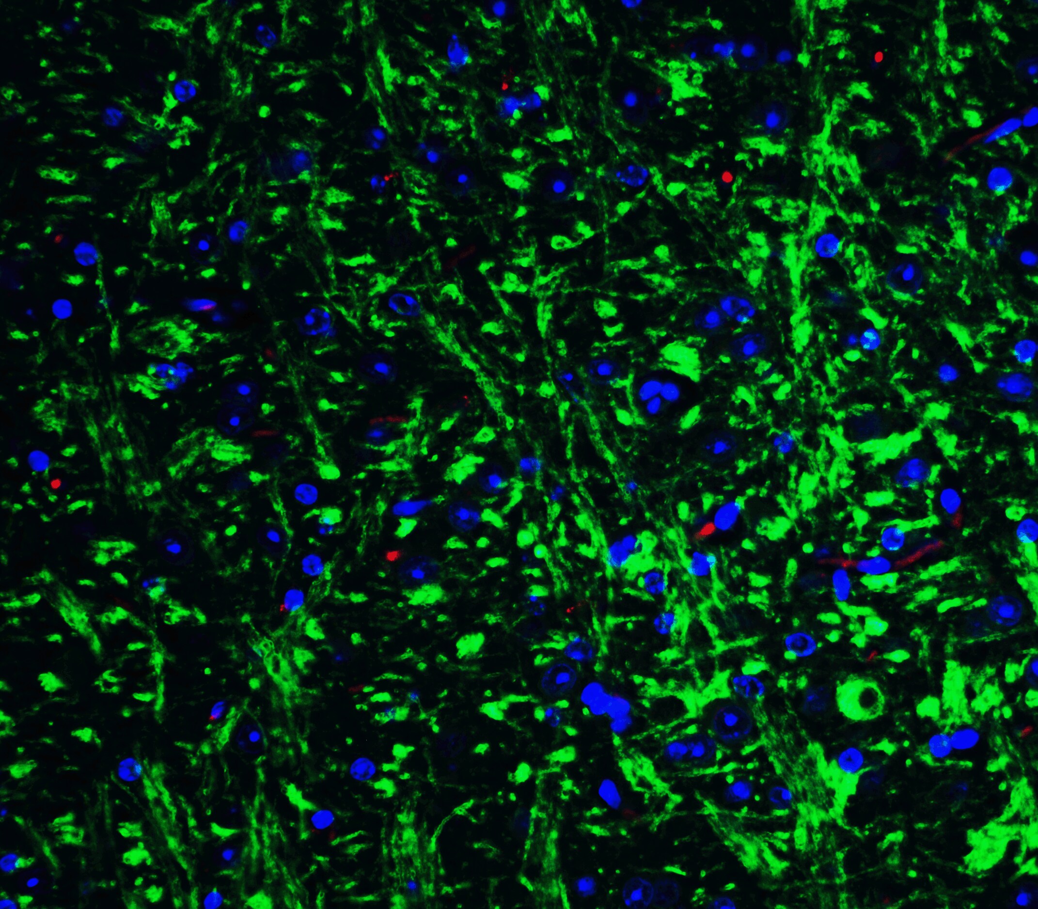GluR5/GRIK1 Antibody - BSA Free