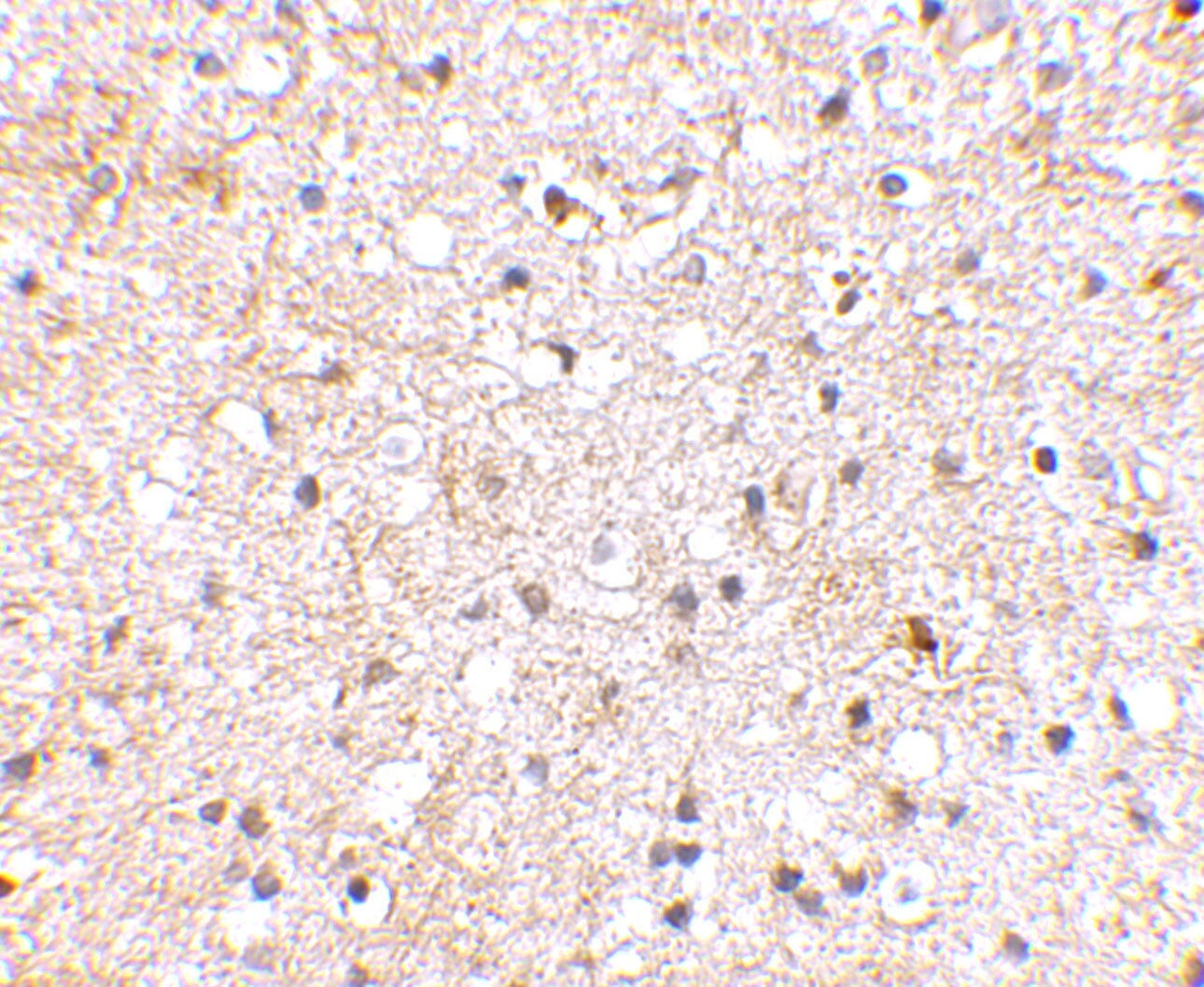 GluR5/GRIK1 Antibody - BSA Free