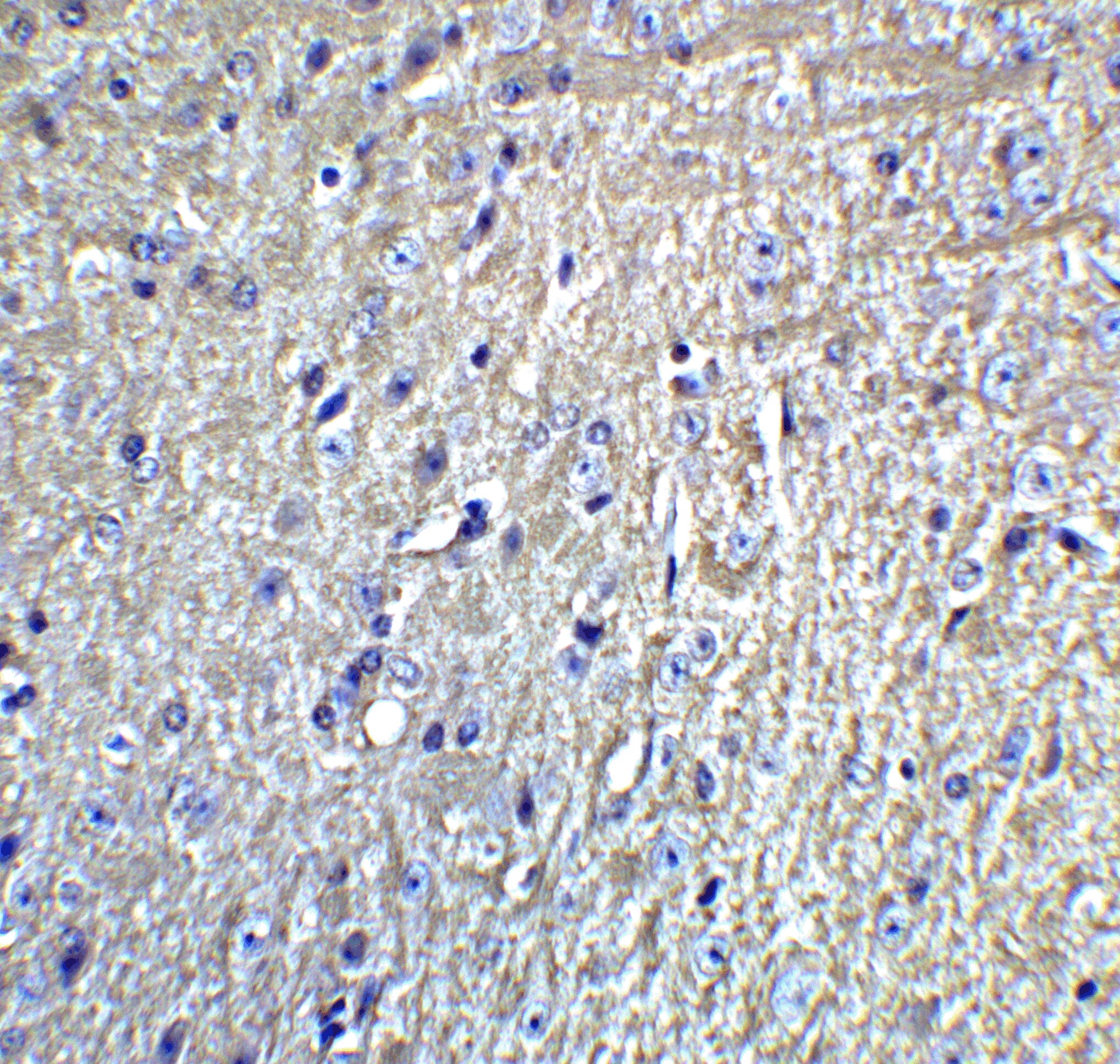GluR5/GRIK1 Antibody - BSA Free
