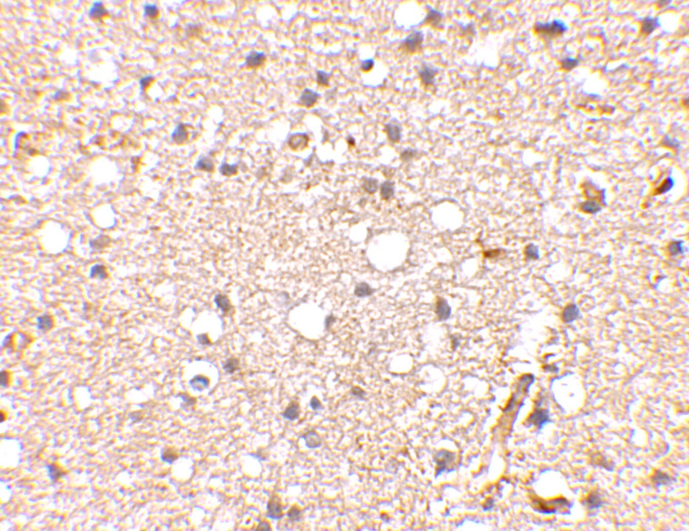 GluR5/GRIK1 Antibody - BSA Free