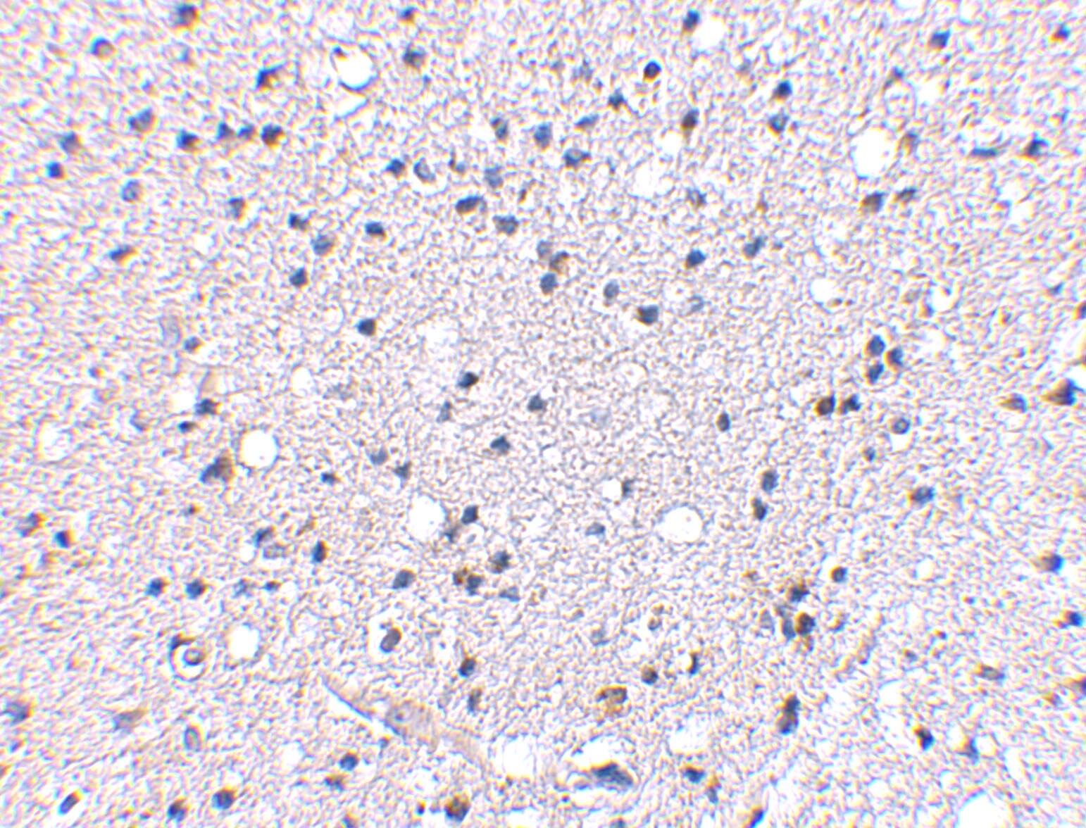 KA1/GRIK4/Glutamate Receptor KA1 Antibody - BSA Free