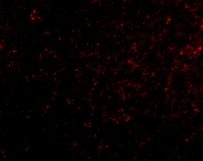 KA1/GRIK4/Glutamate Receptor KA1 Antibody - BSA Free