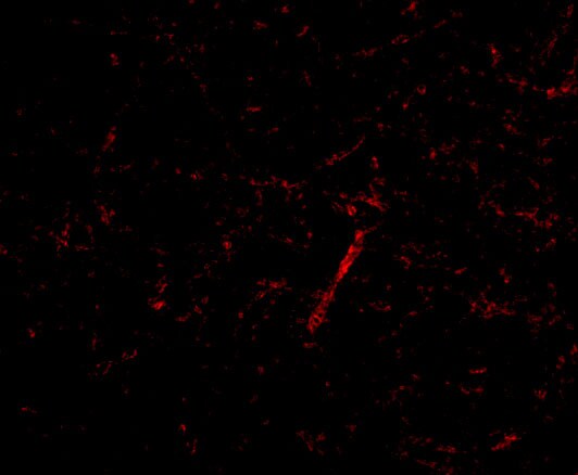 KA1/GRIK4/Glutamate Receptor KA1 Antibody - BSA Free