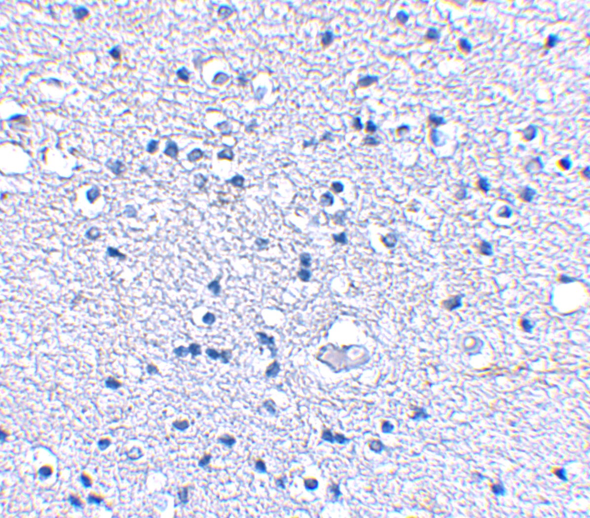 KA1/GRIK4/Glutamate Receptor KA1 Antibody - BSA Free