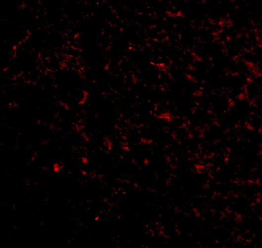 KA2/GRIK5/Glutamate Receptor KA2 Antibody - BSA Free