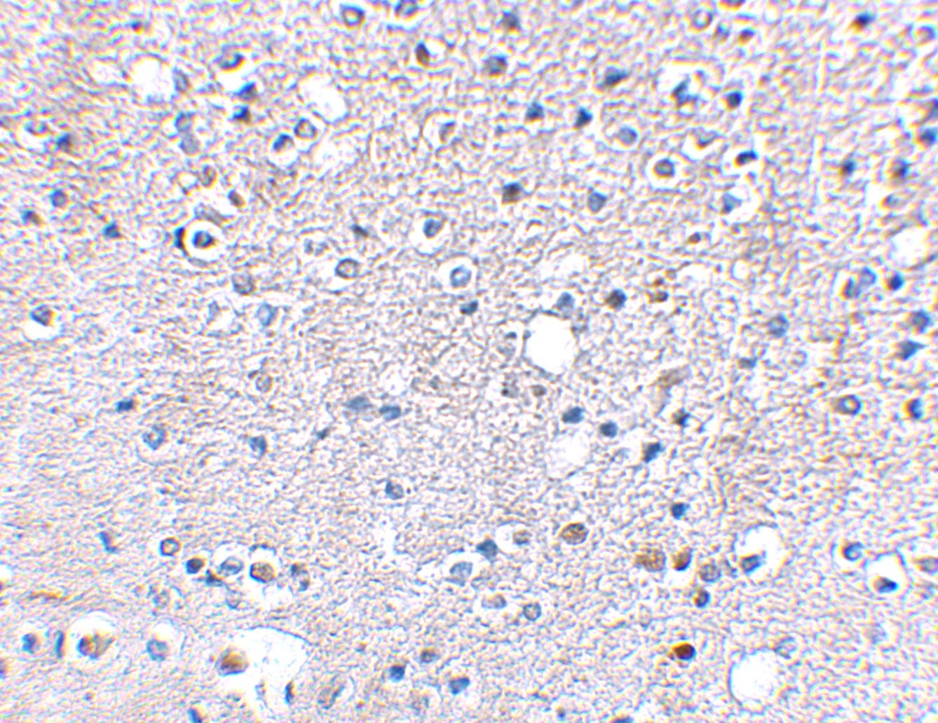 KA2/GRIK5/Glutamate Receptor KA2 Antibody - BSA Free
