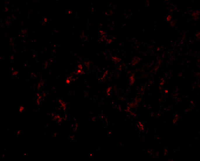 Glutathione S-Transferase pi 1/GSTP1 Antibody - BSA Free