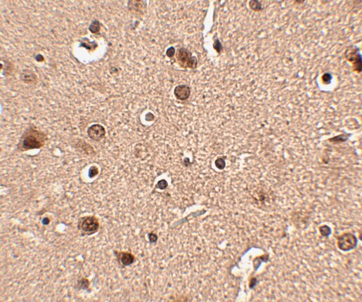 SLITRK4 Antibody - BSA Free