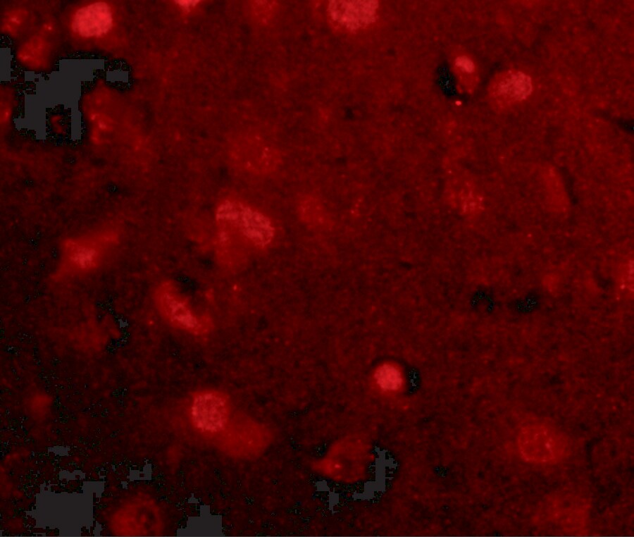 SLITRK4 Antibody - BSA Free