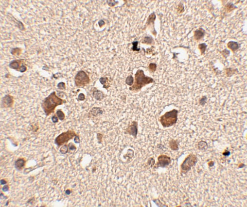 SLITRK6 Antibody - BSA Free