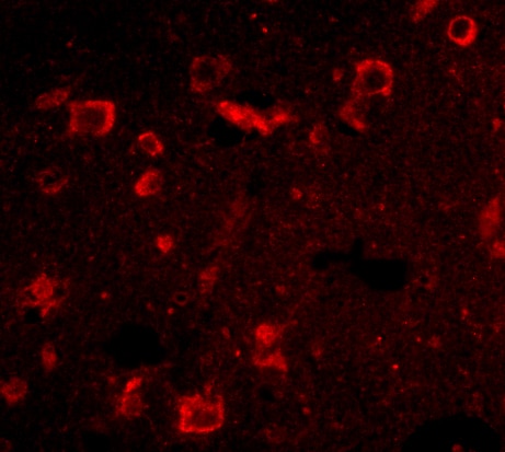SLITRK6 Antibody - BSA Free