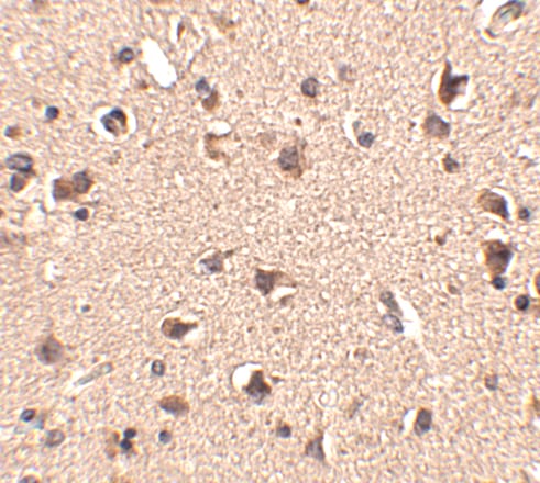 SLITRK6 Antibody - BSA Free