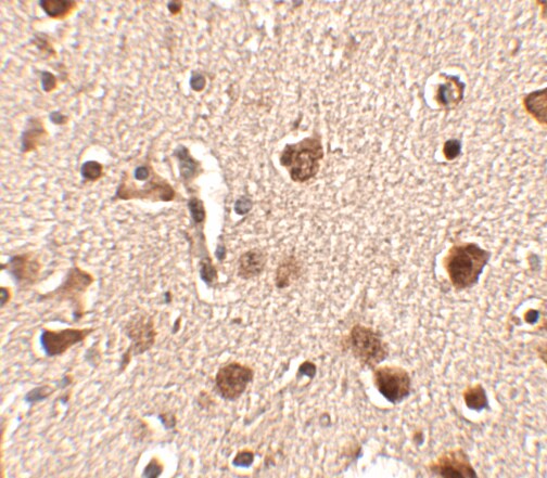 SLITRK4 Antibody - BSA Free