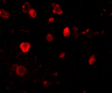 SLITRK4 Antibody - BSA Free
