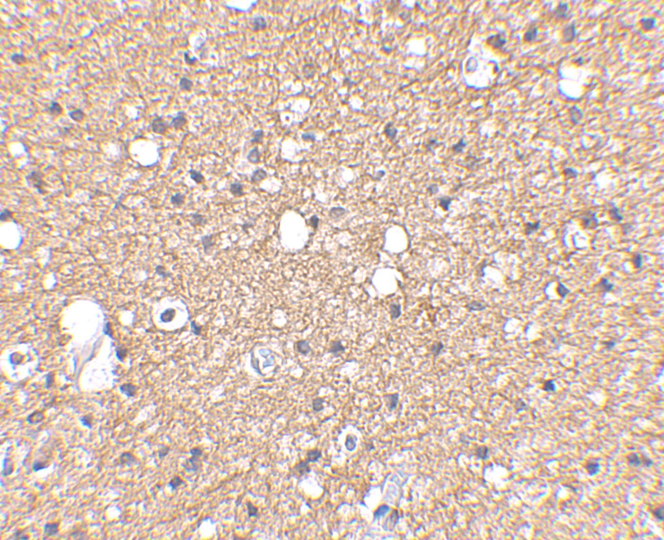Sirtuin 2/SIRT2 Antibody - BSA Free
