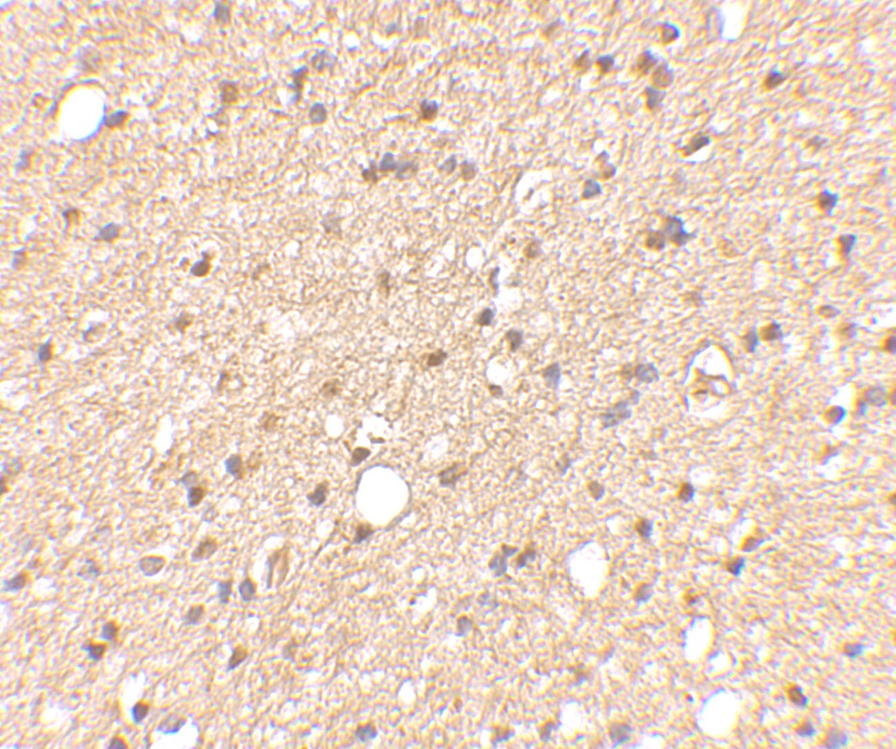 LGI2 Antibody - BSA Free