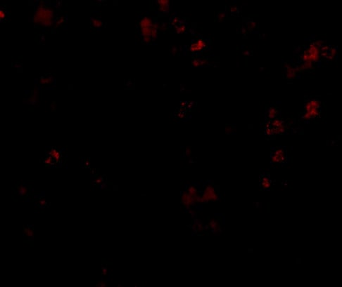 TMC6 Antibody - BSA Free
