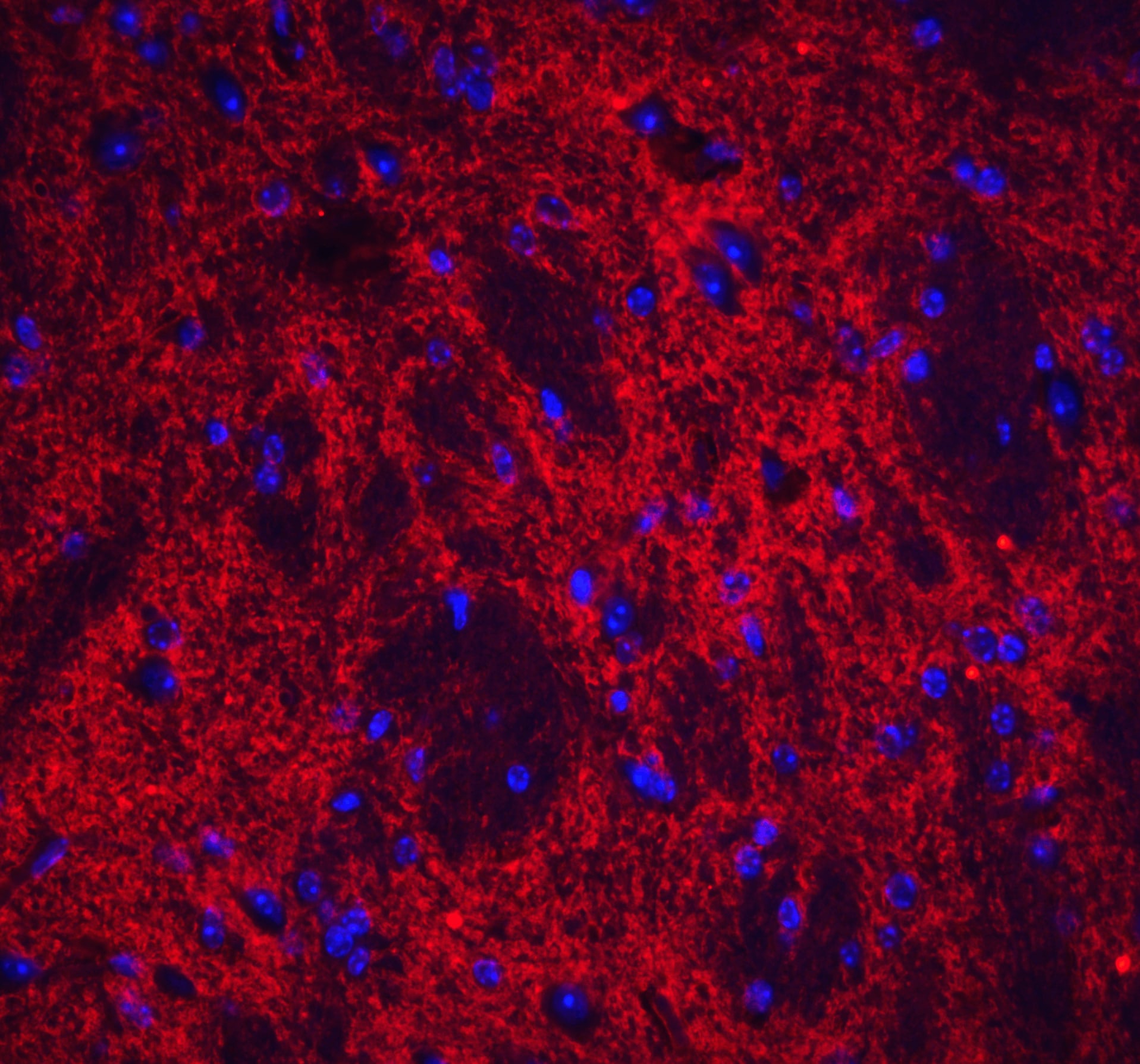 Neuronal Pentraxin 2 Antibody - BSA Free