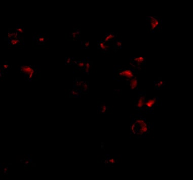 VPS53 Antibody - BSA Free